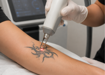 Is Laser Hair Removal Safe What Your Skin Needs to Know