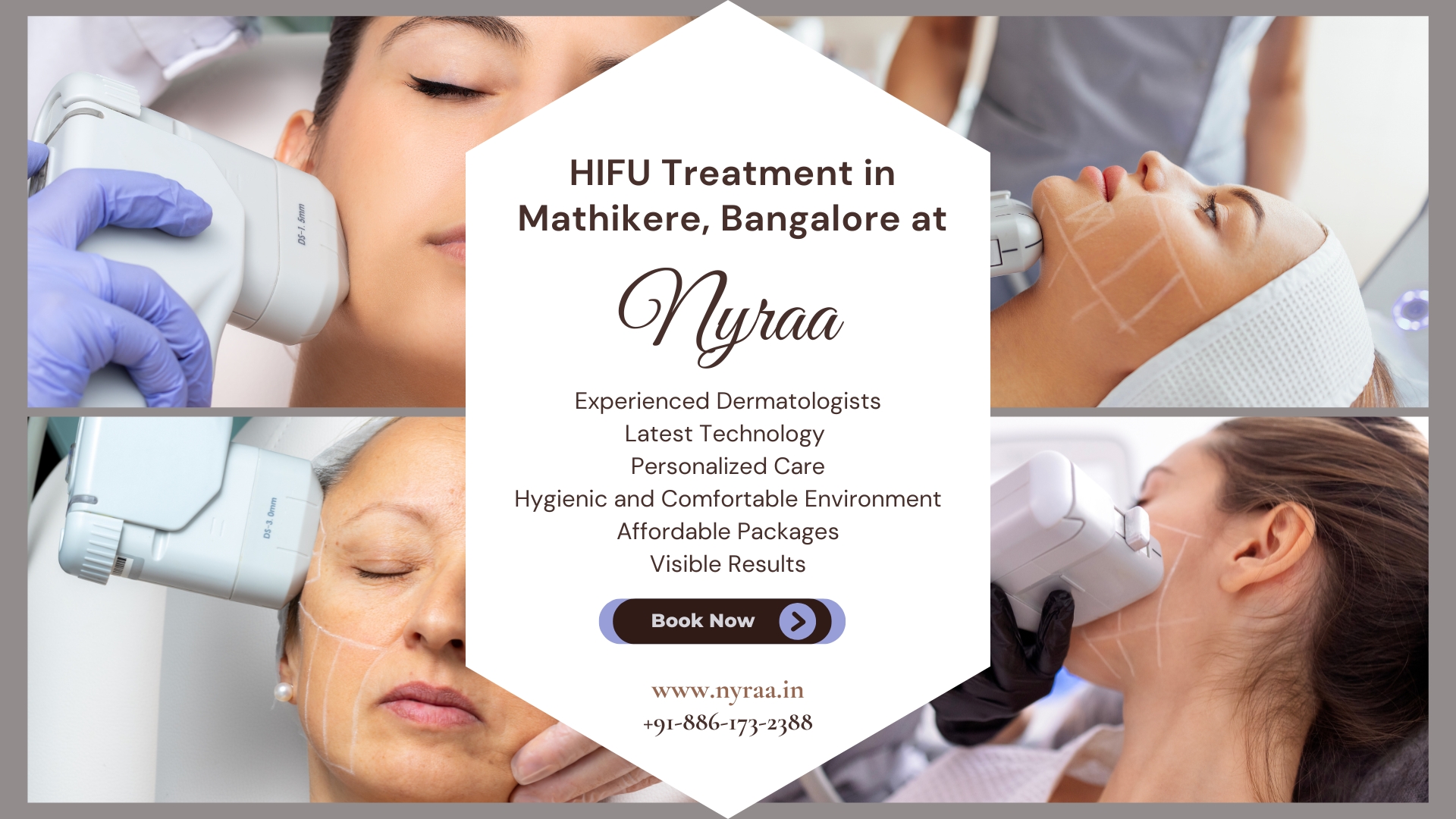 HIFU Treatment in Mathikere