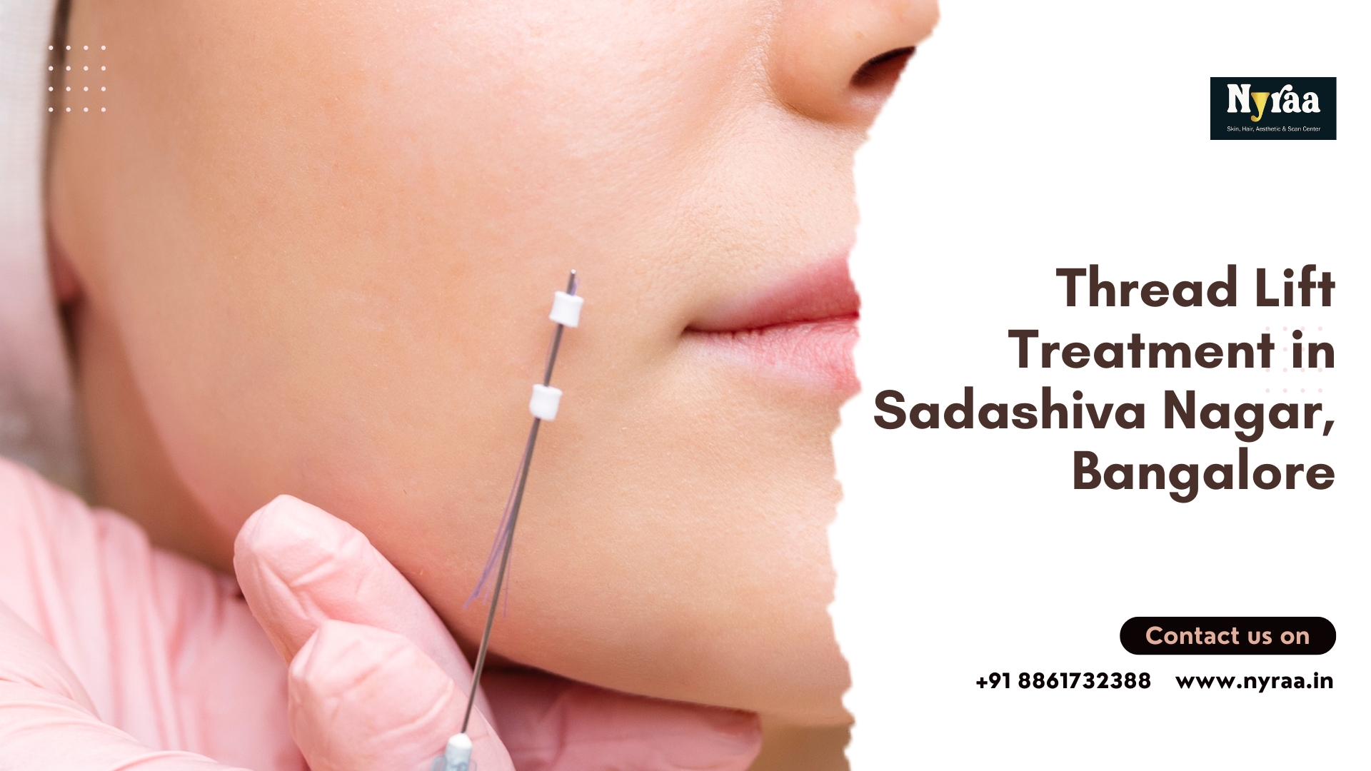 Thread Lift Treatment in Sadashiva Nagar Bangalore