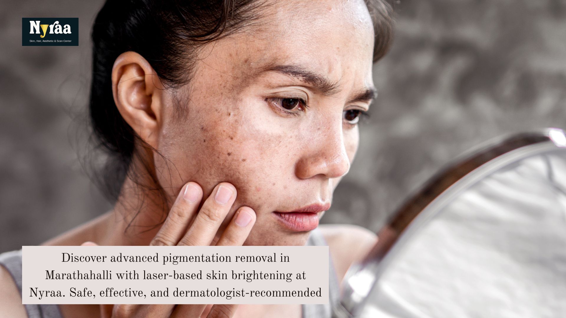 Pigmentation Treatment in Marathahalli for Brighter Skin