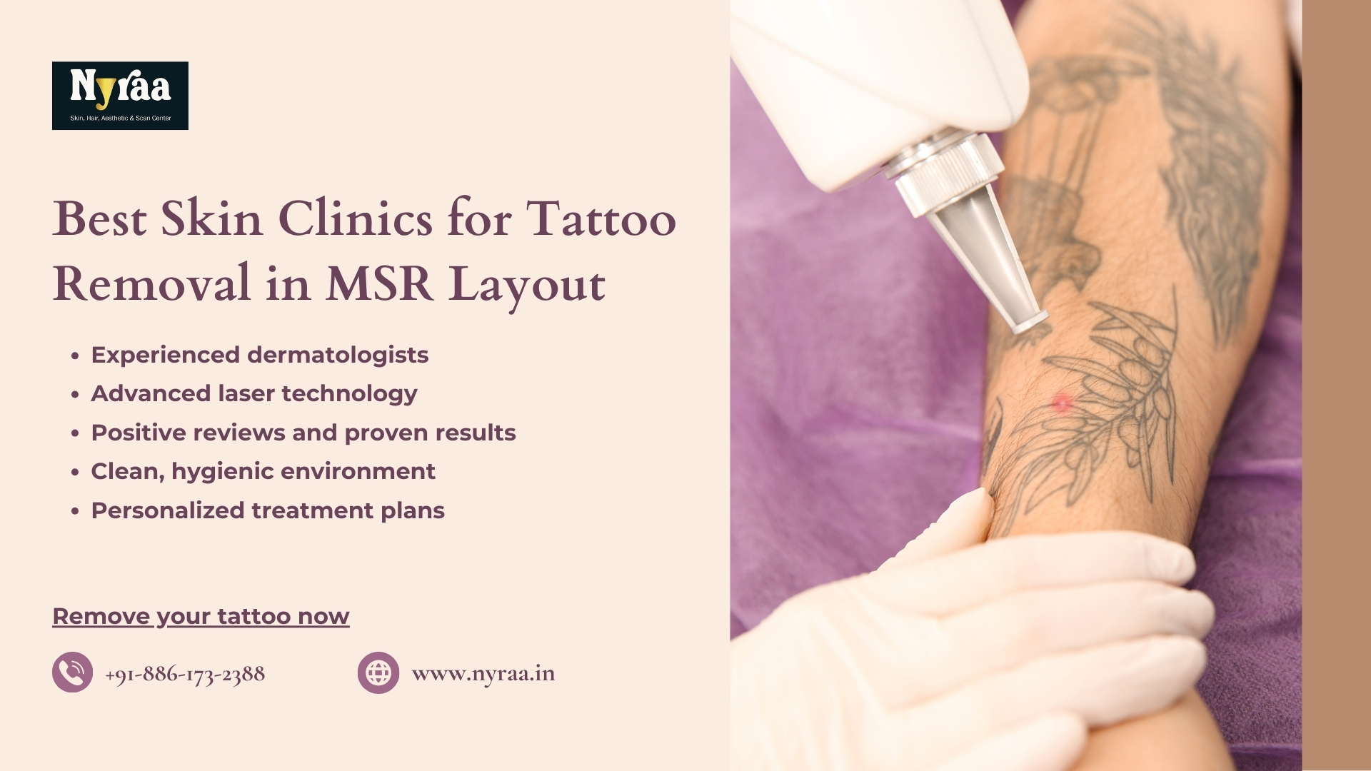 Laser Tattoo Removal in MSR Layout Bangalore