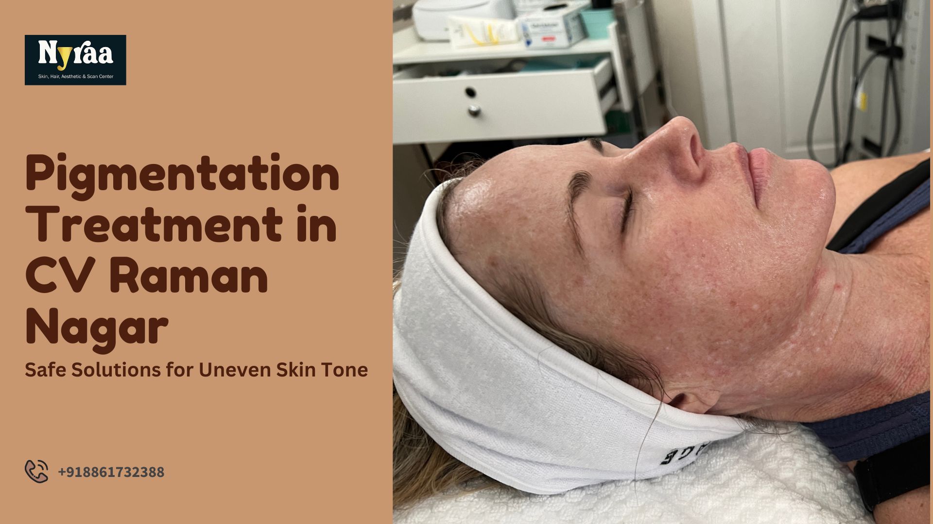 Pigmentation Treatment in CV Raman Nagar