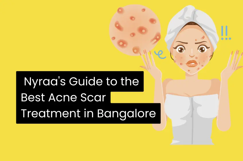 Say Goodbye to Acne Scars Nyraas Guide to the Best Acne Scar Treatment in Bangalore