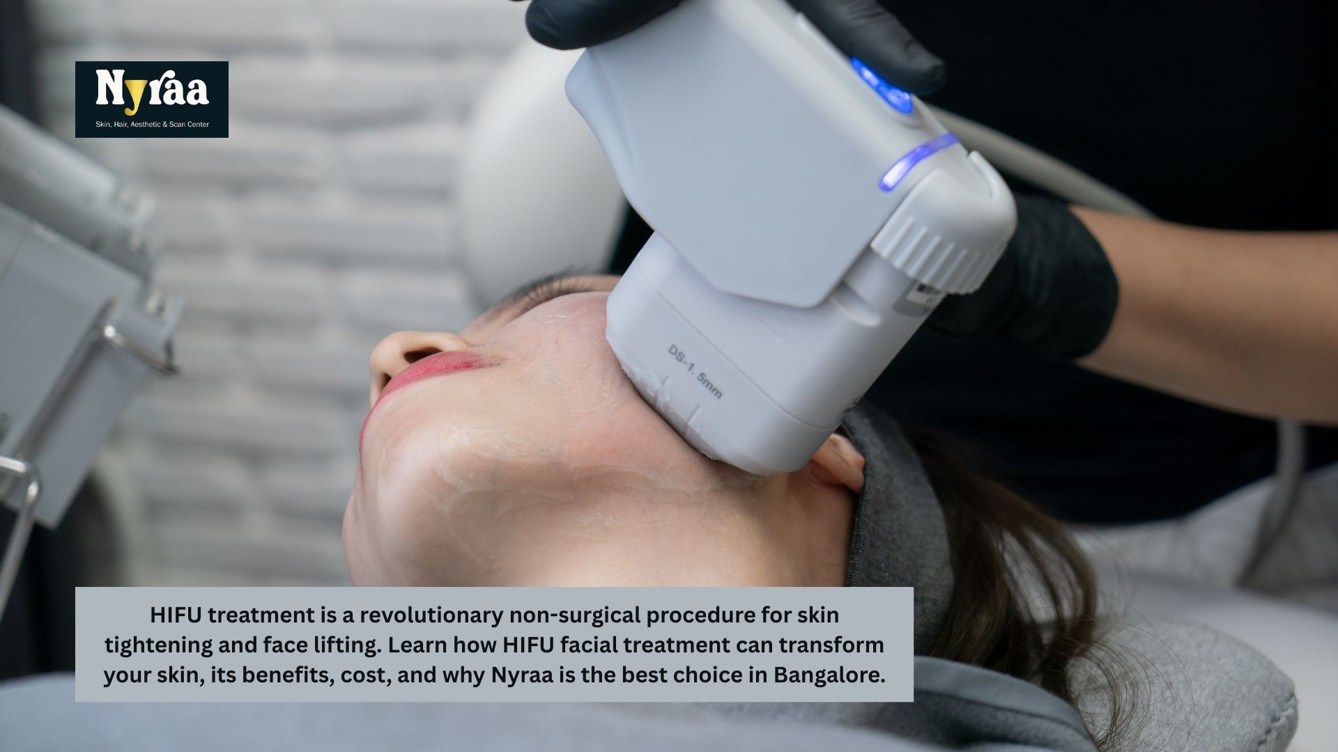 Is HIFU Treatment the New Miracle for Skin Tightening Heres What You Need to Know