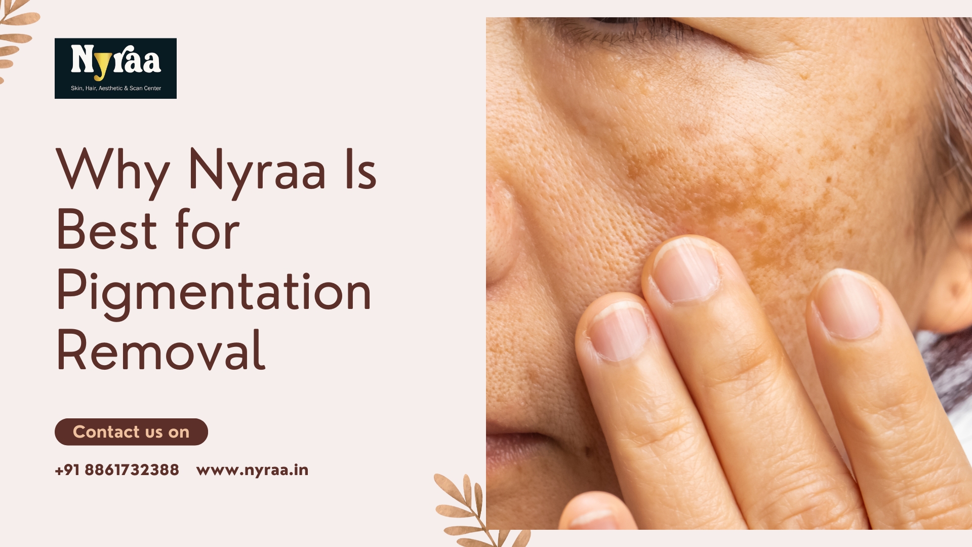 Pigmentation Removal in Bangalore