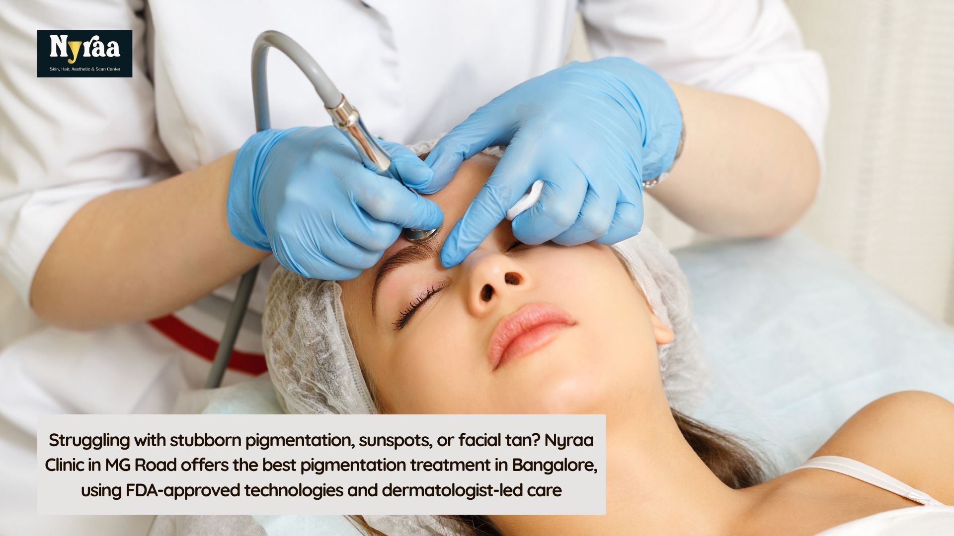 Best Pigmentation Treatment in MG Road to Remove Sunspots  Tan