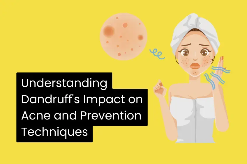 Understanding Dandruff Impact on Acne and Prevention Techniques