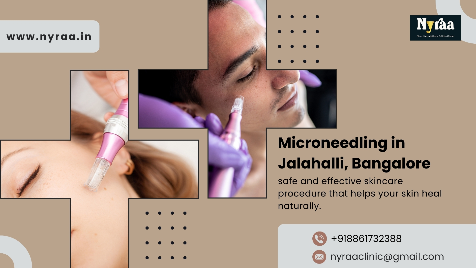 Microneedling in Jalahalli Bangalore