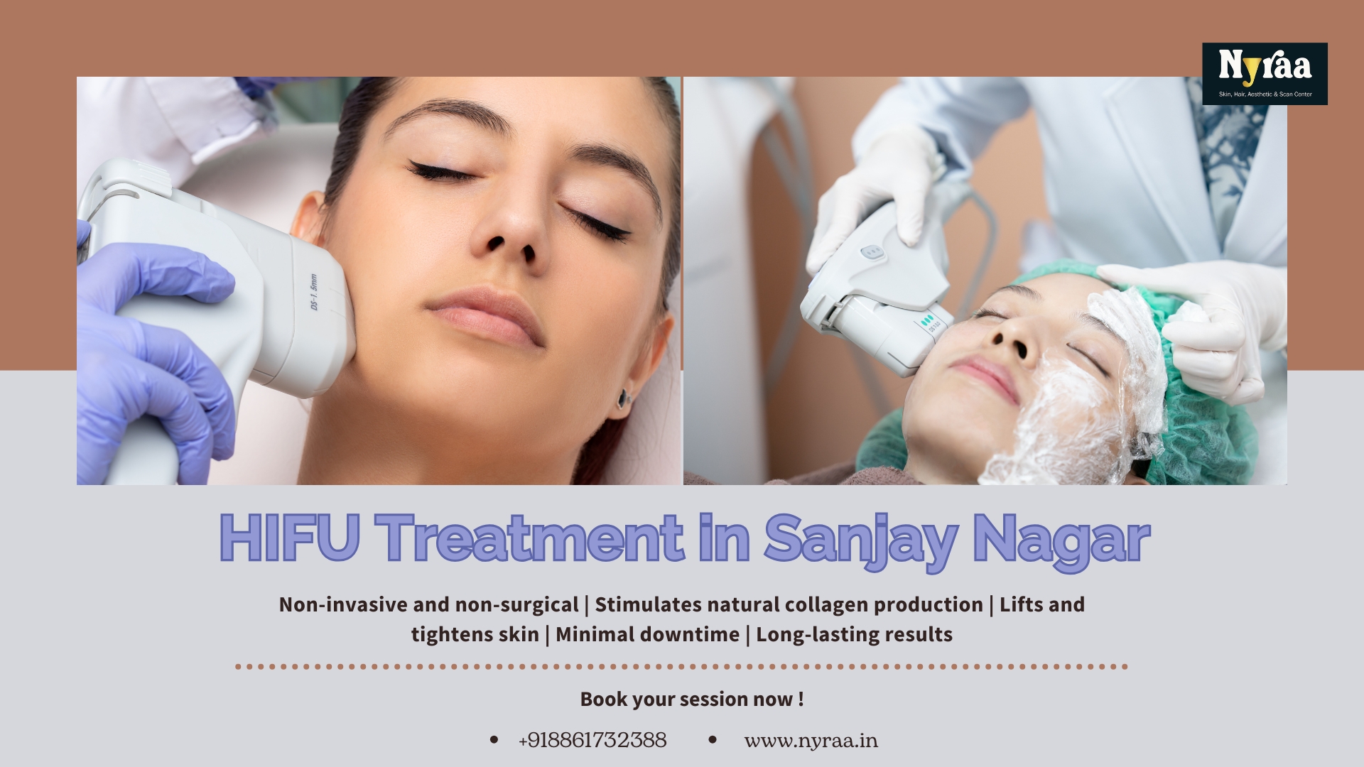 HIFU Treatment in Sanjay Nagar Bangalore