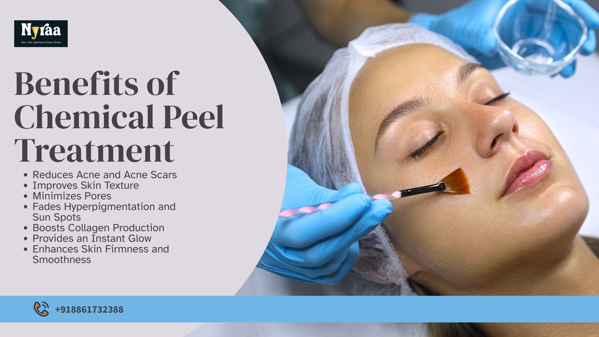 Chemical Peel Treatment in Sanjay Nagar