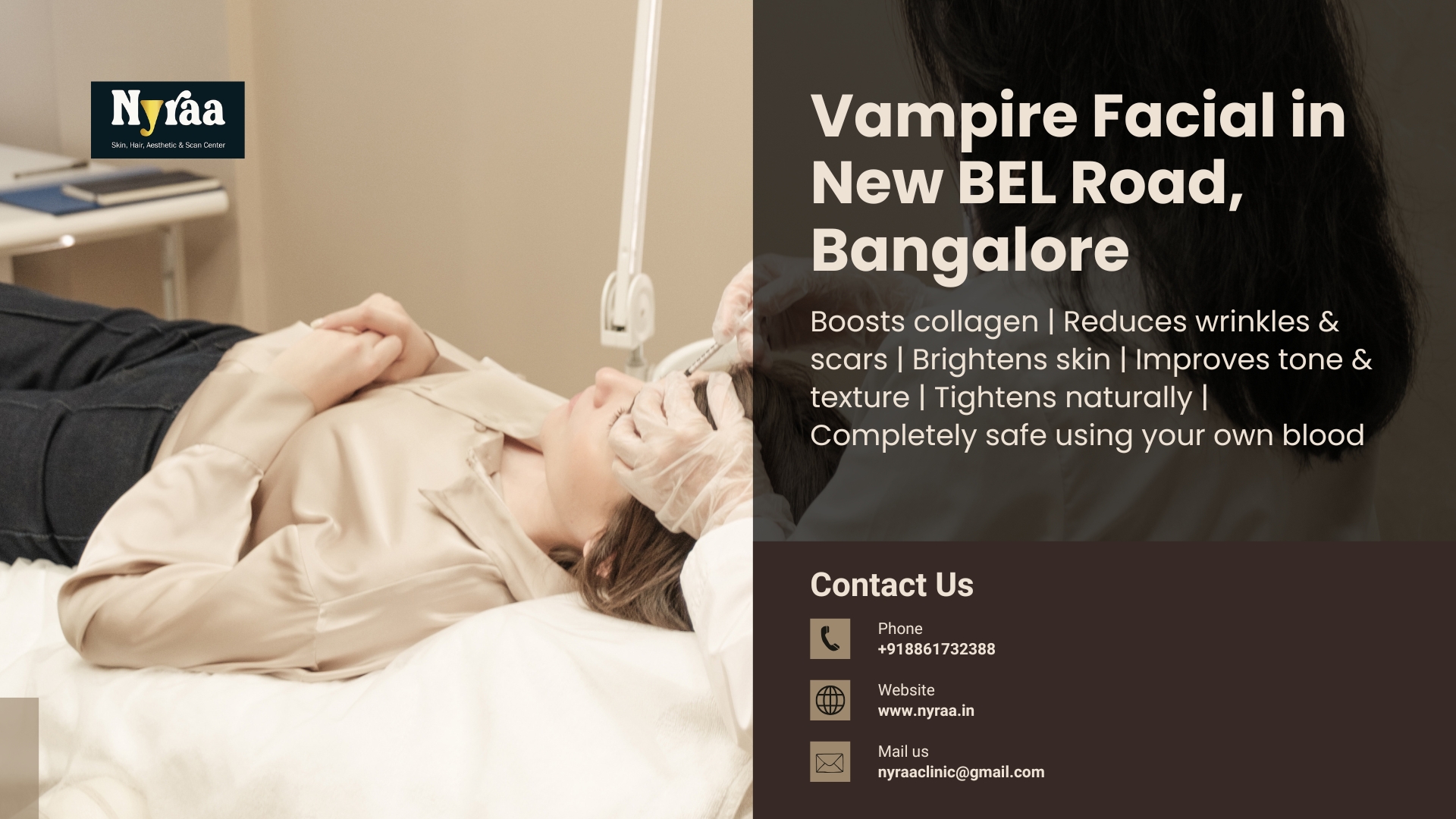 Vampire Facial in New BEL Road Bangalore