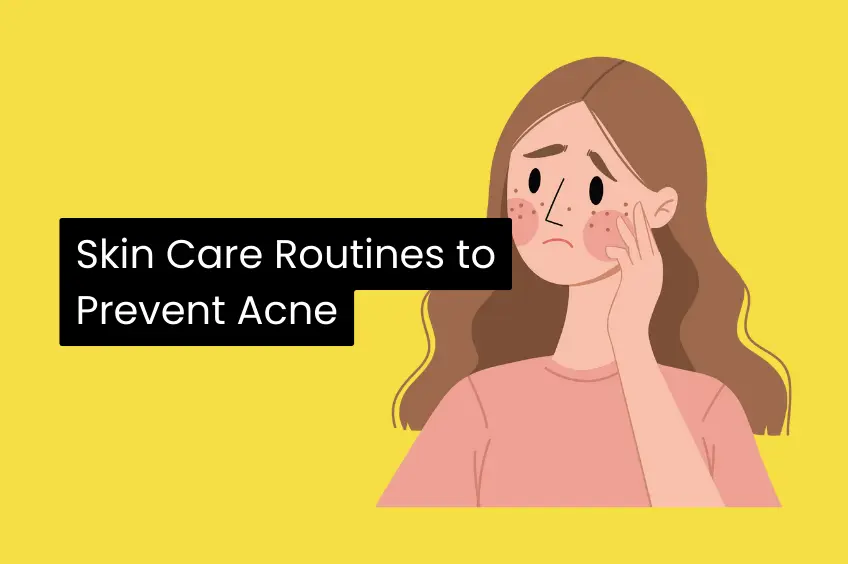 Skin Care Routines to Prevent Acne