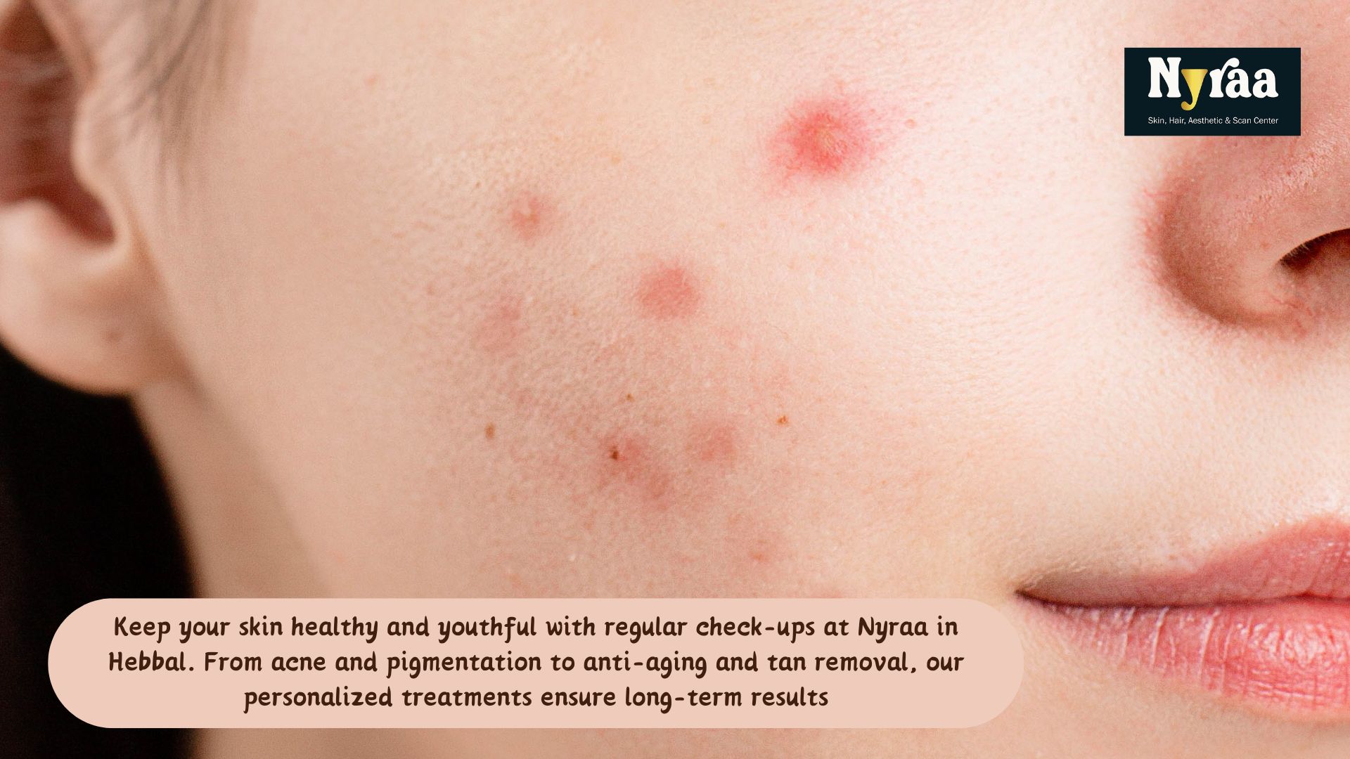 Stay Ahead of Skin Problems The Power of Regular Checkups in Hebbal