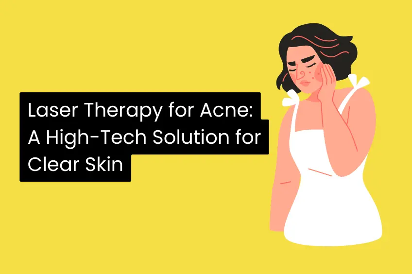 Laser Therapy for Acne A High Tech Solution for Clear Skin