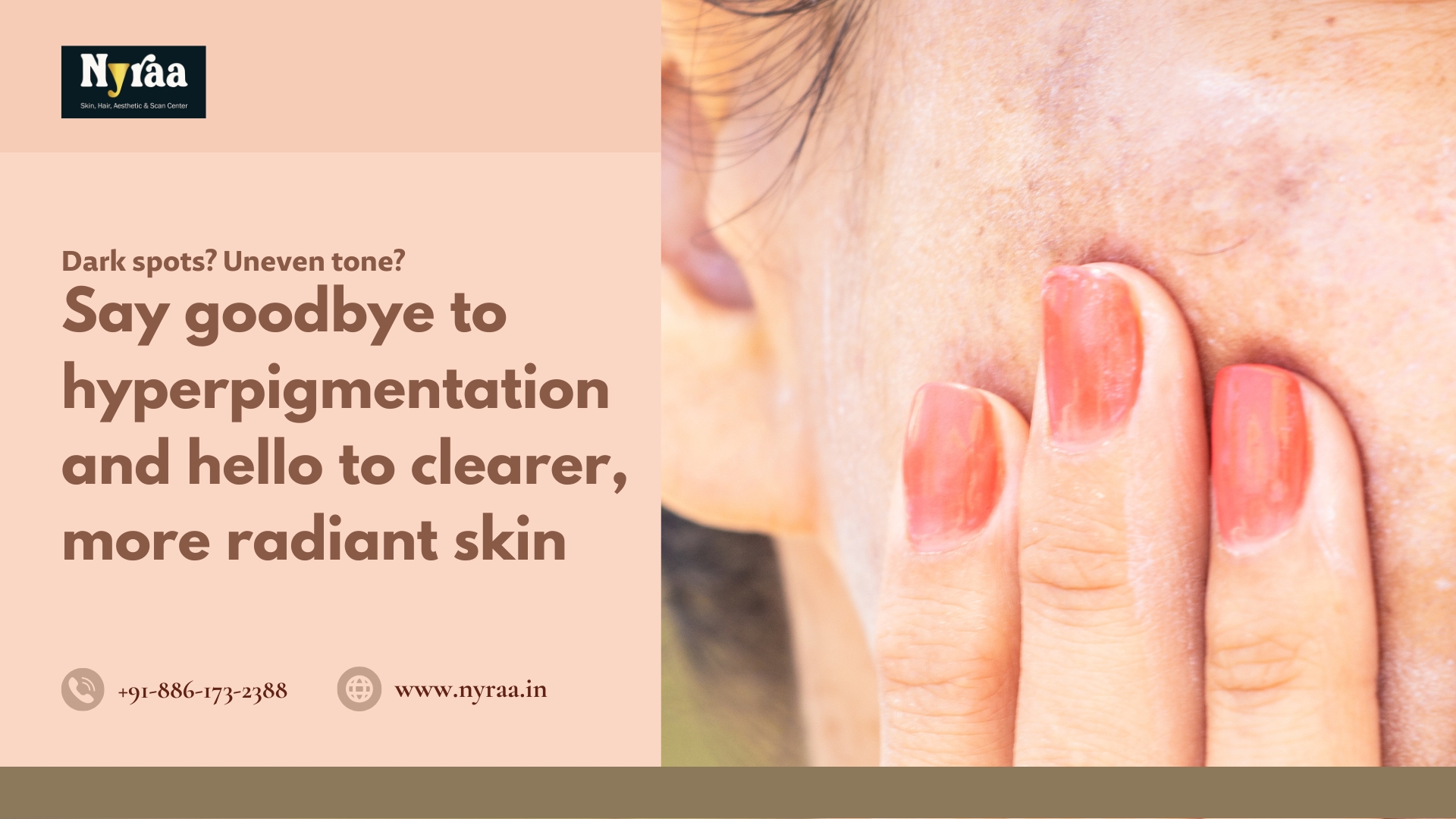 Pigmentation Treatment in Malleswaram Bangalore