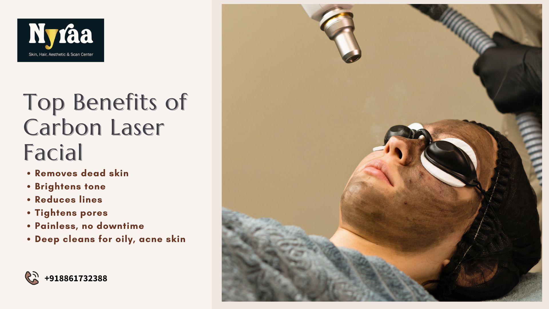 Carbon Laser Peel in Jayanagar  Red Carpet Ready Skin