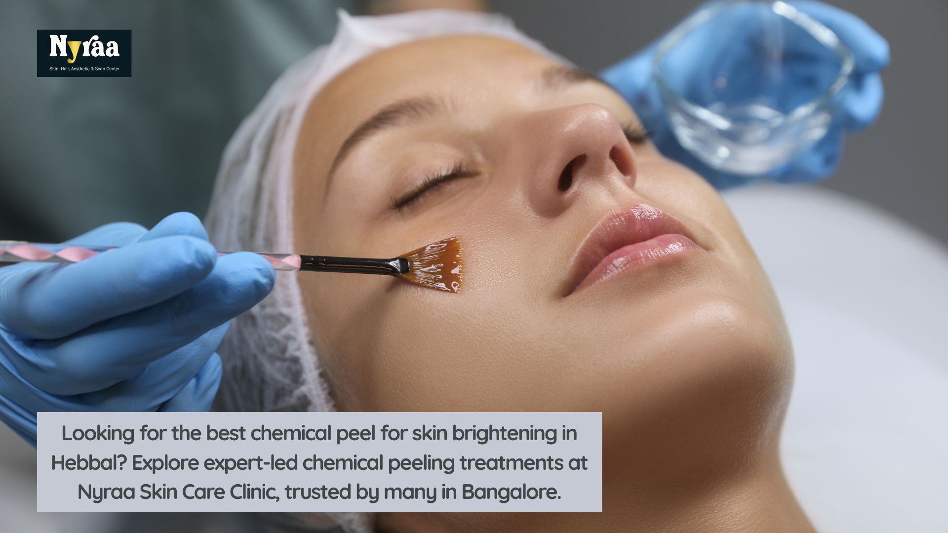 Best Chemical Peel for Skin Brightening in Hebbal