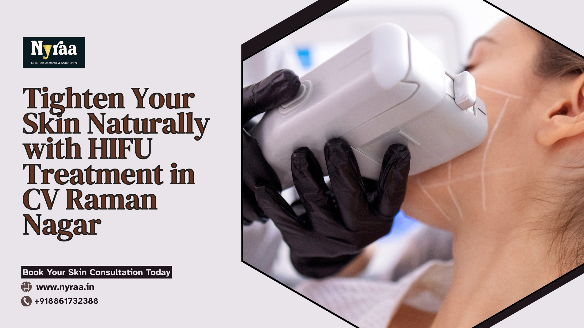 HIFU Treatment in CV Raman Nagar