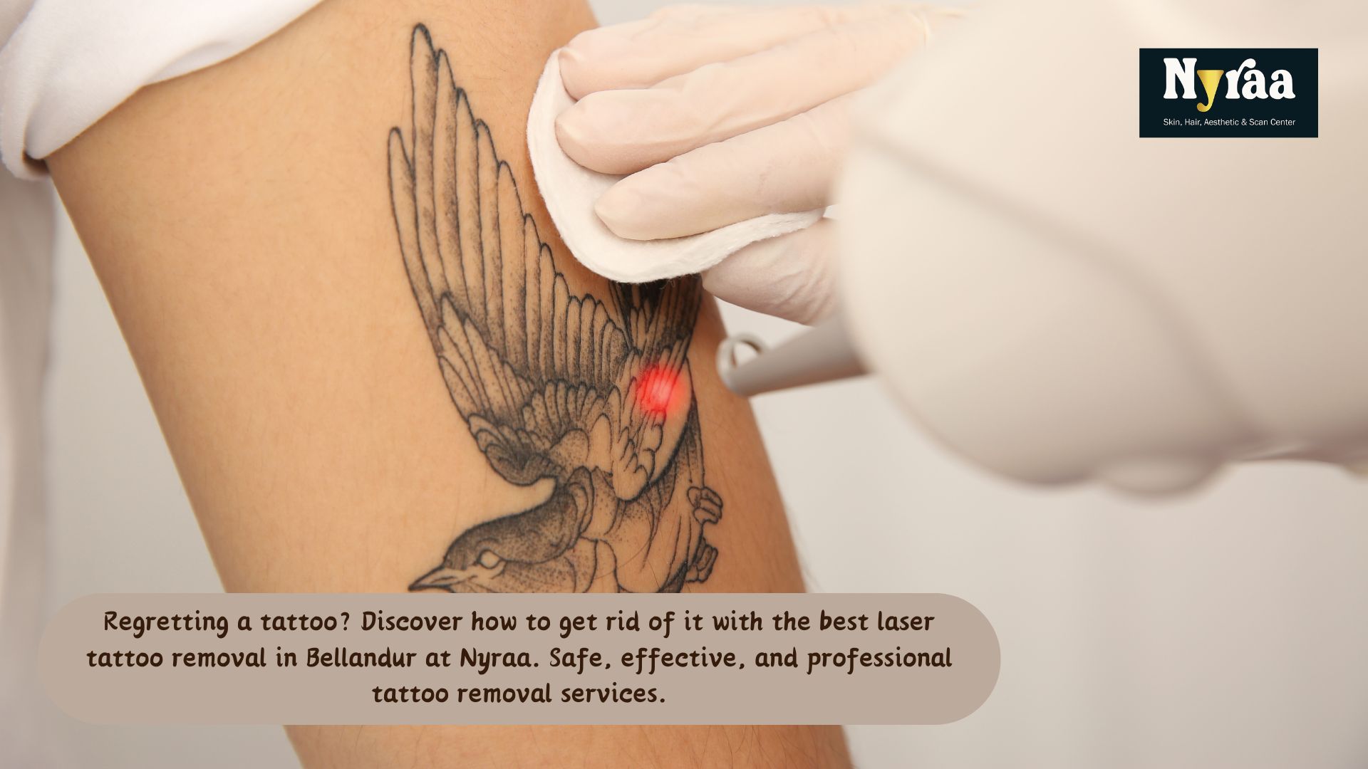 How to Get Rid of a Tattoo You Regret Best Laser Removal in Bellandur