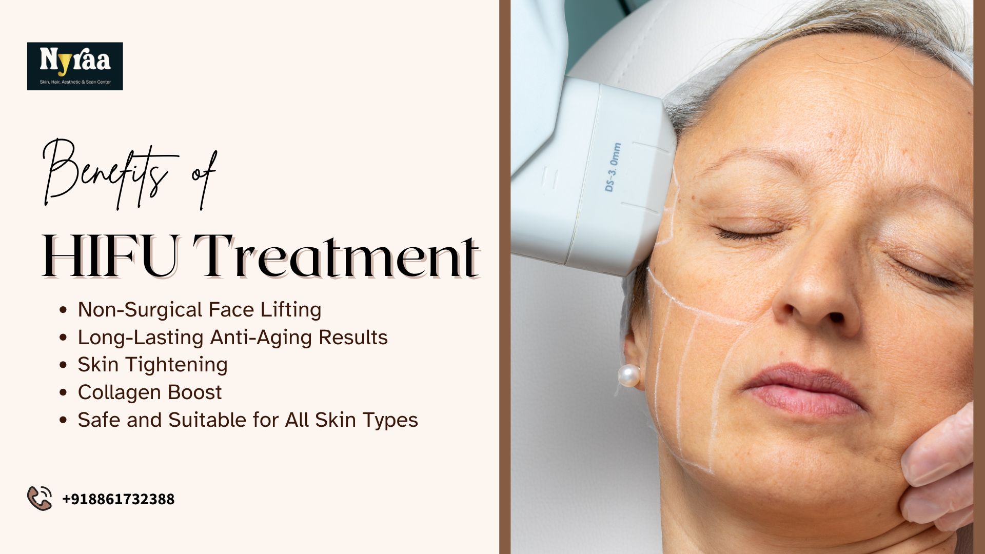 HIFU Treatment in Devasandra Layout