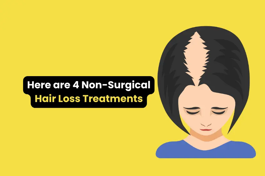 Here are Four Non Surgical Hair Loss Treatments