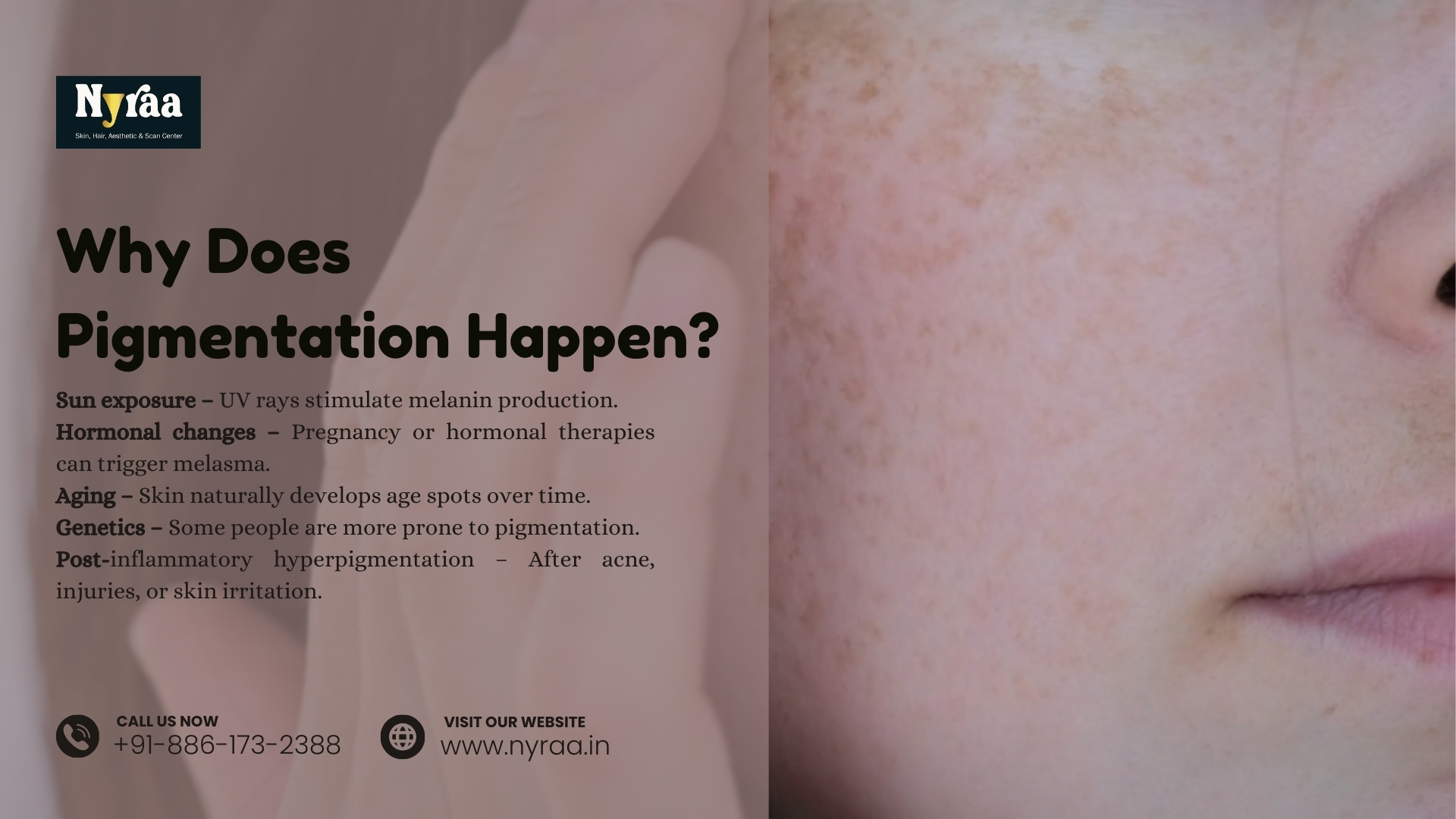 Pigmentation Treatment in Devasandra Layout Bangalore