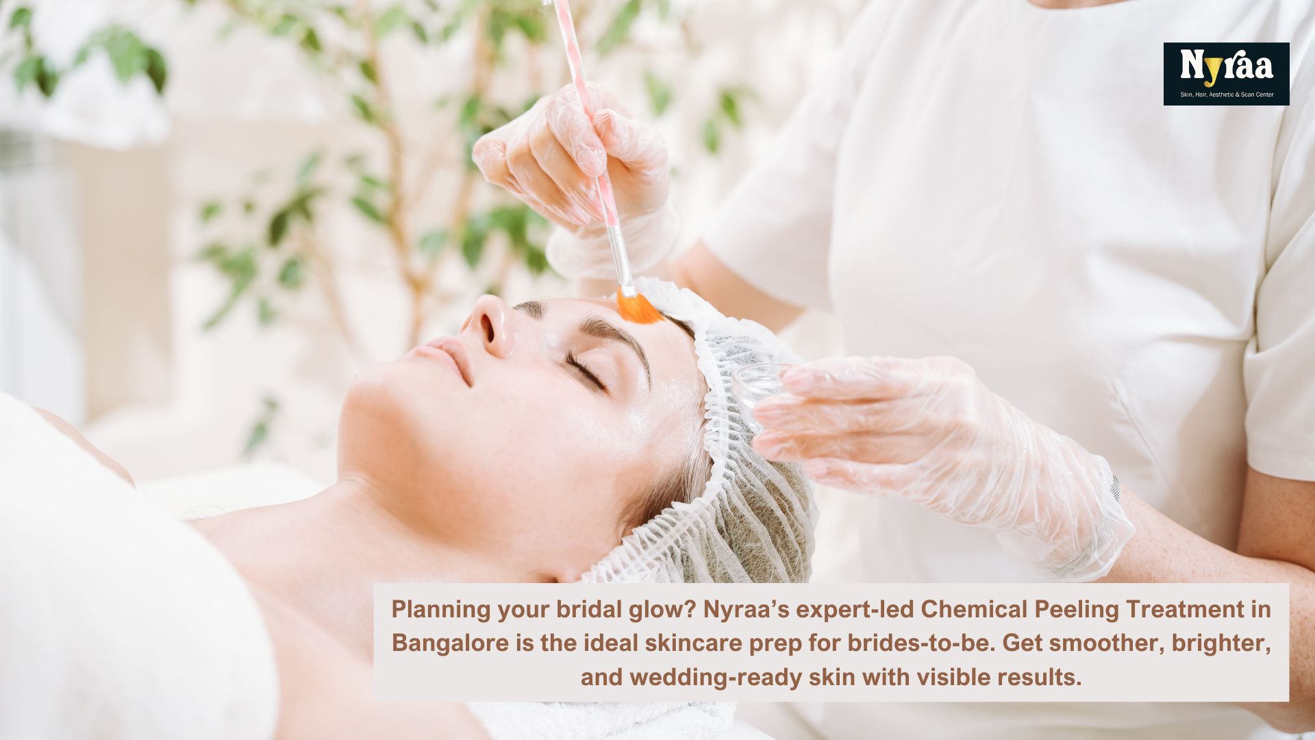 Chemical Peeling for BridestoBe Preparing Your Skin for the Big Day