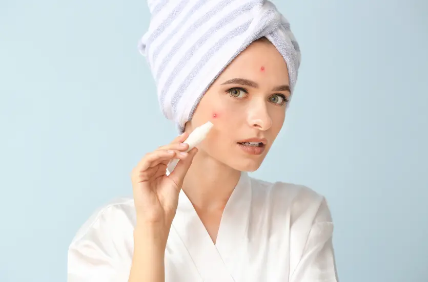 How to Find the Right Dermatologist for Acne Treatment in Bangalore