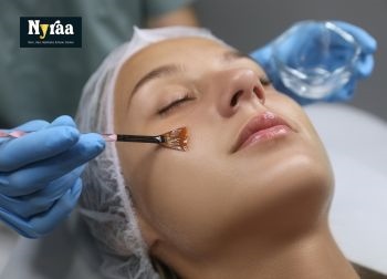 Chemical Peeling Treatment in Jalahalli