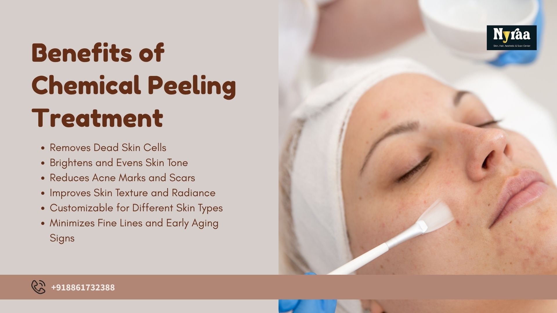 Chemical Peeling Treatment in Jalahalli