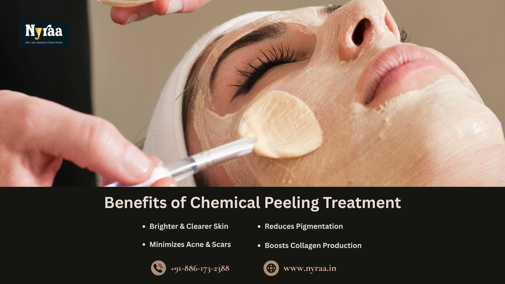 Chemical Peeling Treatment in HMT Layout Bangalore